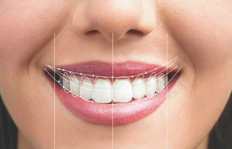 Digital Smile Designing